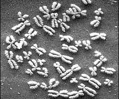 Selbstgestrickte Chromosomen